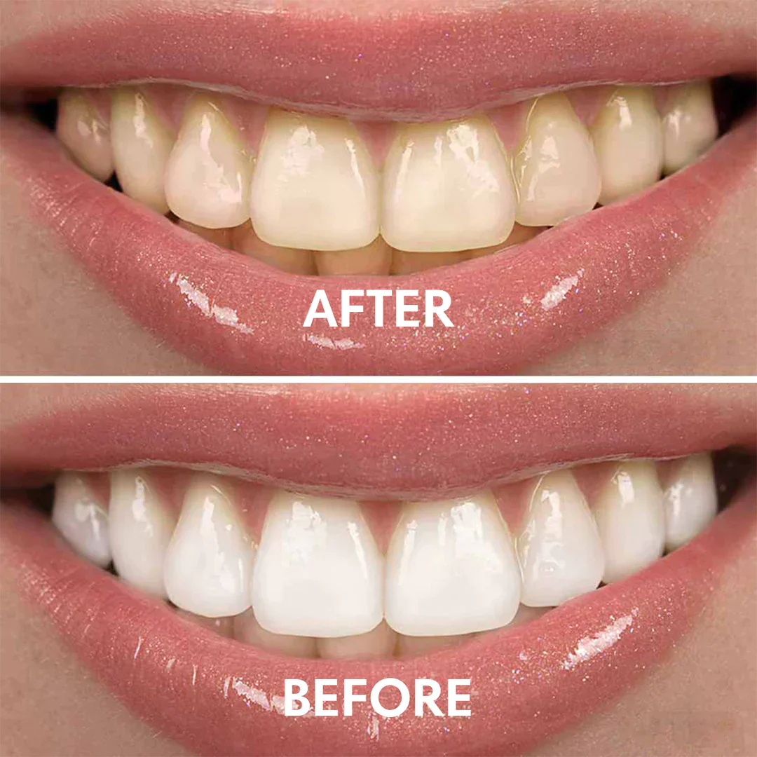 V34 Bright Smile Teeth Whitening Mousse